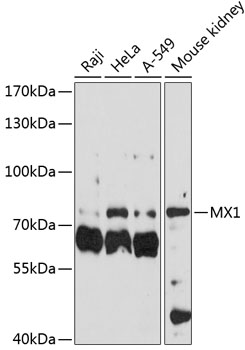 Western blot - MX1 Polyclonal Antibody 