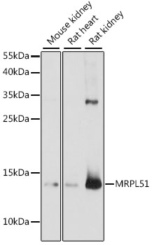 Western blot - MRPL51 Polyclonal Antibody 