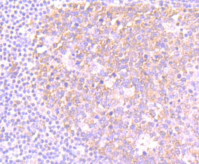 Fig7: Immunohistochemical analysis of paraffin-embedded human tonsil tissue using anti-NLRC3 antibody. Counter stained with hematoxylin.