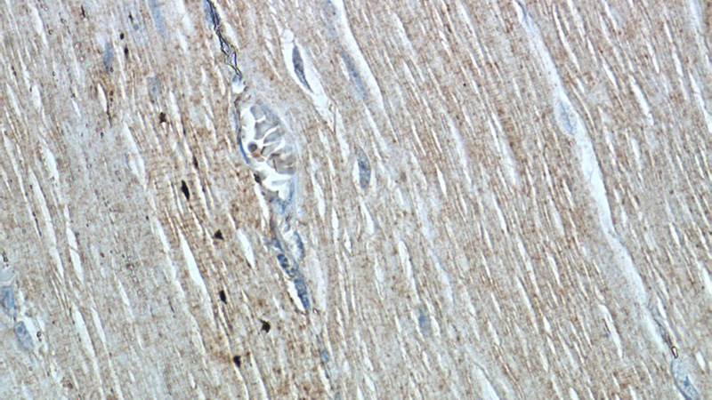 Immunohistochemistry of paraffin-embedded human skeletal muscle tissue slide using Catalog No:113465(OBSCN Antibody) at dilution of 1:50 (under 40x lens)
