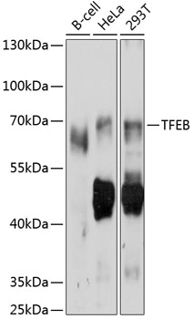 Western blot - TFEB Polyclonal Antibody 