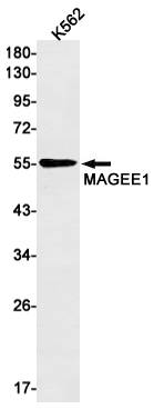 Western blot detection of MAGEE1 in K562 cell lysates using MAGEE1 Rabbit mAb(1:1000 diluted).Predicted band size:41kDa.Observed band size:55kDa.