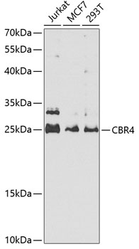 Western blot - CBR4 Polyclonal Antibody 