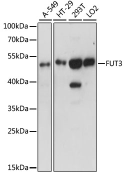 Western blot - FUT3 Polyclonal Antibody 