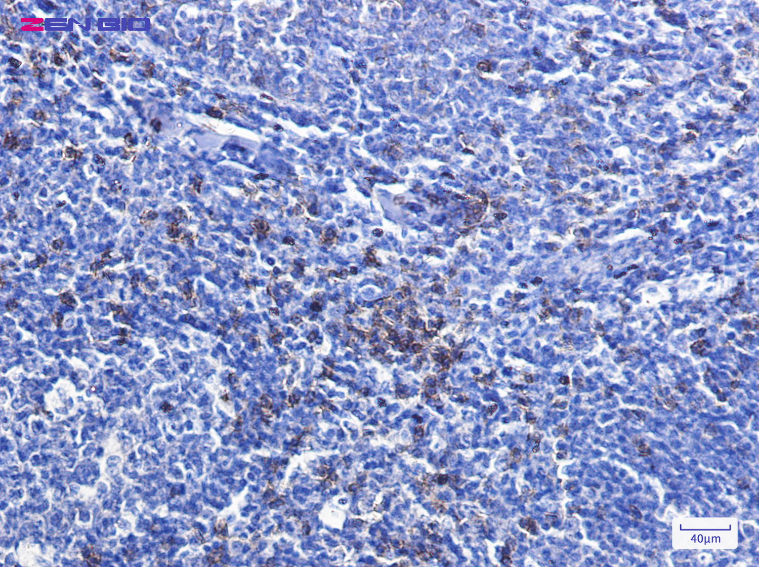 Immunohistochemistry of CD8 in paraffin-embedded Human tonsil using CD8 Rabbit pAb at dilution 1/100