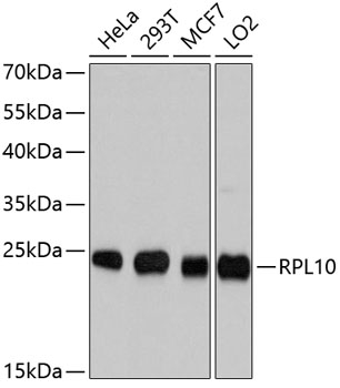 Western blot - RPL10 Polyclonal Antibody 
