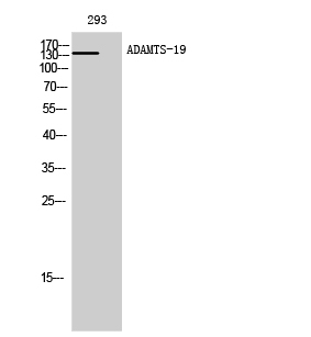 Fig1:; Western Blot analysis of 293 cells using ADAMTS-19 Polyclonal Antibody