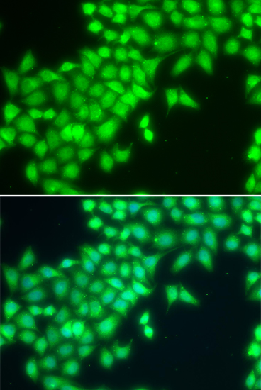 Immunofluorescence - METTL2A Polyclonal Antibody 