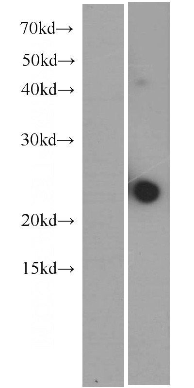Untransfeted HEK293 cells (left) and IL23A transfected HEK293 cells (right) were subjected to SDS-PAGE followed by western blot with Catalog No:107394 (IL23A monoclonal Antibody) at dilution of 1:1000