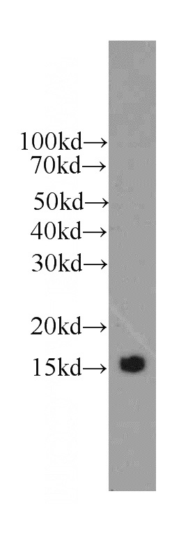 human brain tissue were subjected to SDS PAGE followed by western blot with Catalog No:107483(TTR antibody) at dilution of 1:1000