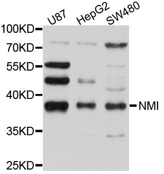 Western blot - NMI Polyclonal Antibody 