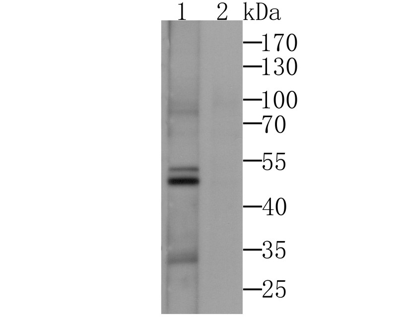 Fig1: Western blot analysis of CACNG3 on SH-SY-5Y cell lysates using anti-CACNG3 antibody.; Lane 1: Anti-CACNG3 Antibody (1:500).; Lane 2: Anti-CACNG3 Antibody, pre-incubated with the immunizaiton peptide.