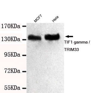 Western blot detection of TIF1 gamma / TRIM33 in MCF7 and Hela cell lysates using TIF1 gamma / TRIM33 mouse mAb (1:1000 diluted).Predicted band size: 120KDa.Observed band size: 140KDa.