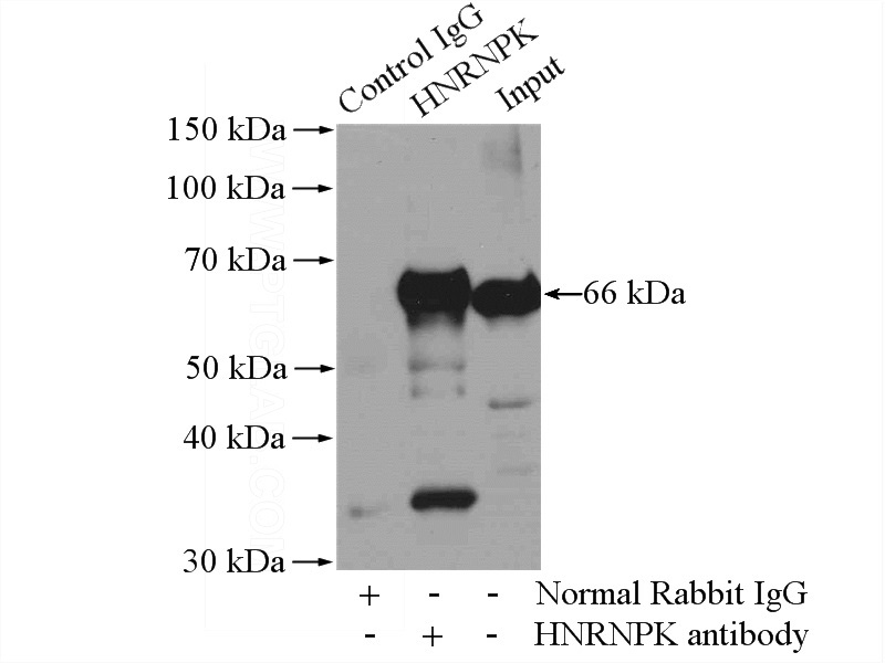 IP Result of anti-HNRNPK (IP:Catalog No:111509, 4ug; Detection:Catalog No:111509 1:1000) with HeLa cells lysate 2000ug.