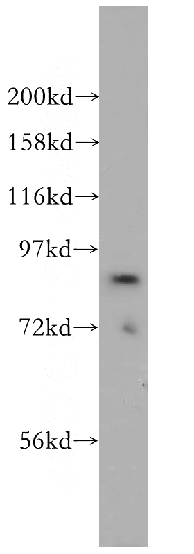 NIH/3T3 cells were subjected to SDS PAGE followed by western blot with Catalog No:107725(ACAP2 antibody) at dilution of 1:300