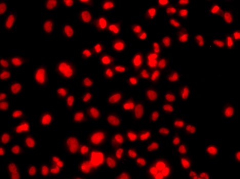 Immunofluorescence - PRICKLE2 Polyclonal Antibody 