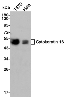 Western blot detection of Cytokeratin 16 in T47D and Hela cell lysates using Cytokeratin 16 mouse mAb (1:3000 diluted).Predicted band size:51kDa.Observed band size:51kDa.