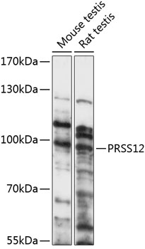 Western blot - PRSS12 Polyclonal Antibody 