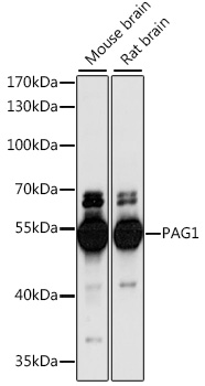 Western blot - PAG1 Polyclonal Antibody 