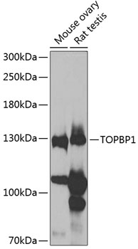 Western blot - TOPBP1 Polyclonal Antibody 