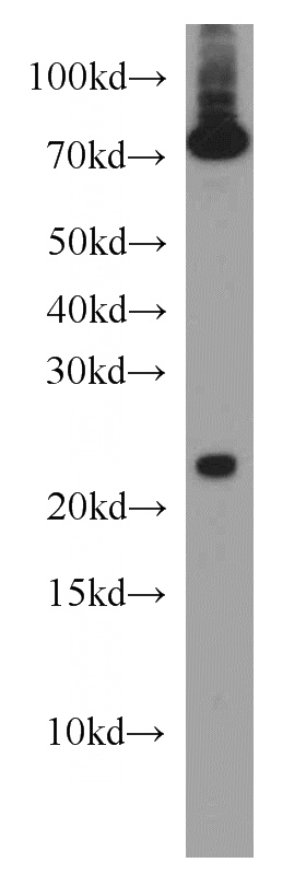 Jurkat cells were subjected to SDS PAGE followed by western blot with Catalog No:108145(ARL6IP6 antibody) at dilution of 1:1000