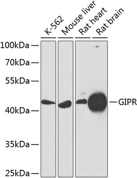 Western blot - GIPR Polyclonal Antibody 