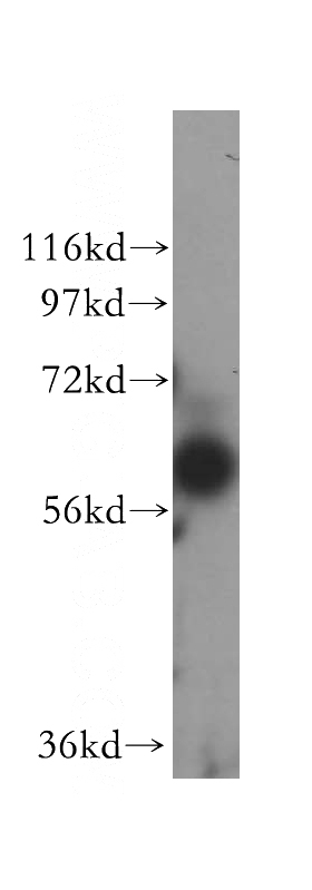 MCF7 cells were subjected to SDS PAGE followed by western blot with Catalog No:108546(BTN2A2 antibody) at dilution of 1:500