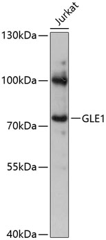 Western blot - GLE1 Polyclonal Antibody 