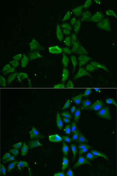 Immunofluorescence - DDX1 Polyclonal Antibody 