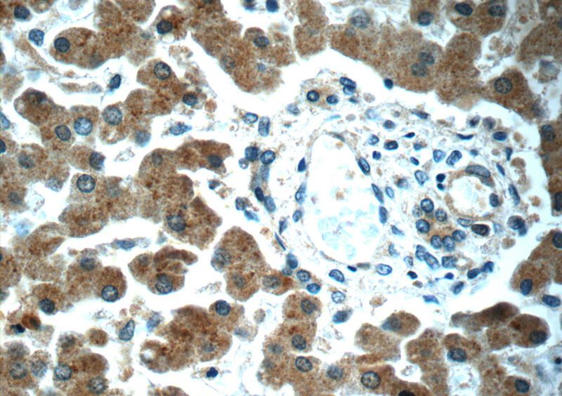 Immunohistochemistry of paraffin-embedded human liver slide using Catalog No:112036(KHDC1 Antibody) at dilution of 1:50 (under 40x lens)