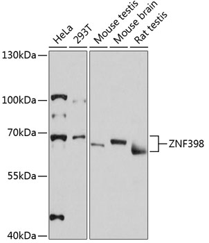 Western blot - ZNF398 Polyclonal Antibody 
