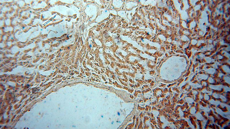 Immunohistochemical of paraffin-embedded human liver using Catalog No:107799(ADPGK antibody) at dilution of 1:50 (under 10x lens)