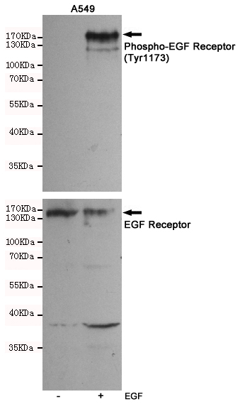 Western blot analysis of extracts of A549 cells, untreated or EGF-stimulated, using Phospho-EGF Receptor (Tyr1173) Rabbit pAb (upper,1:500 diluted) and EGF Receptor Antibody 201012-6H11 (lower,1:500 diluted).