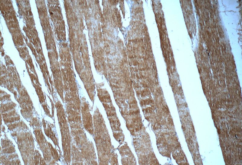 Immunohistochemistry of paraffin-embedded human skeletal muscle tissue slide using Catalog No:113000(MYPN-Specific Antibody) at dilution of 1:50 (under 10x lens)