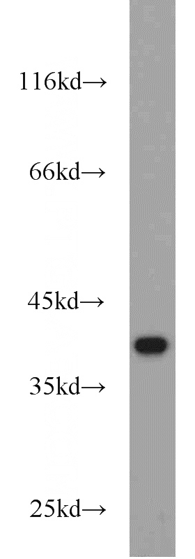 mouse eye tissue were subjected to SDS PAGE followed by western blot with Catalog No:114783(ROM1 antibody) at dilution of 1:400