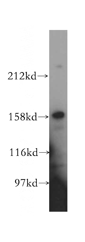 HeLa cells were subjected to SDS PAGE followed by western blot with Catalog No:115389(SMG5 antibody) at dilution of 1:400