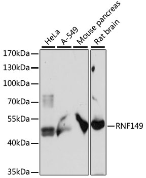 Western blot - RNF149 Polyclonal Antibody 