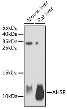 Western blot - AHSP Polyclonal Antibody 