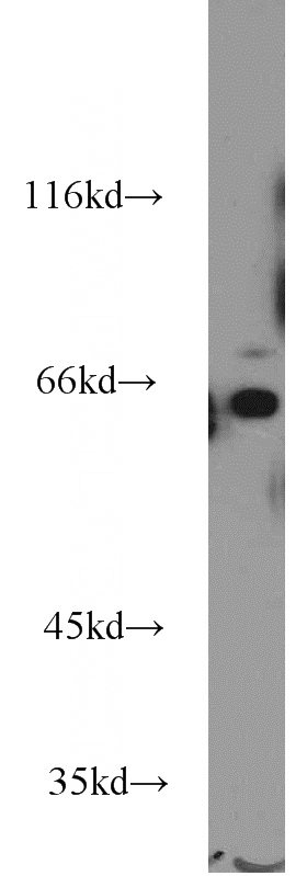 Jurkat cells were subjected to SDS PAGE followed by western blot with Catalog No:116820(WEE2 antibody) at dilution of 1:500