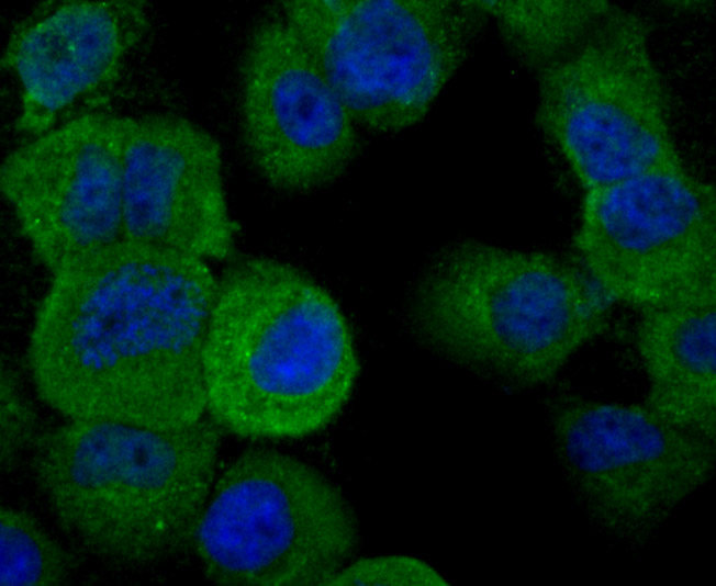 Fig2: ICC staining IL19 in HUVEC cells (green). The nuclear counter stain is DAPI (blue). Cells were fixed in paraformaldehyde, permeabilised with 0.25% Triton X100/PBS.