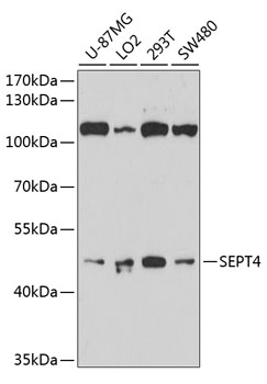Western blot - SEPT4 Polyclonal Antibody 