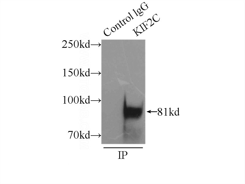 IP Result of anti-KIF2C (IP:Catalog No:112012, 3ug; Detection:Catalog No:112012 1:500) with mouse testis tissue lysate 8000ug.