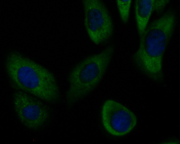 Fig3:; ICC staining of SLC8B1 in SKOV-3 cells (green). Formalin fixed cells were permeabilized with 0.1% Triton X-100 in TBS for 10 minutes at room temperature and blocked with 1% Blocker BSA for 15 minutes at room temperature. Cells were probed with the primary antibody ( 1/100) for 1 hour at room temperature, washed with PBS. Alexa Fluor®488 Goat anti-Rabbit IgG was used as the secondary antibody at 1/100 dilution. The nuclear counter stain is DAPI (blue).