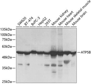 Western blot - ATP5B Polyclonal Antibody 