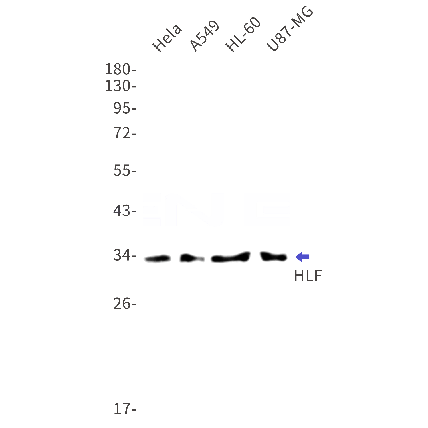 Western blot detection of HLF in Hela,A549,HL-60,U87-MG cell lysates using HLF Rabbit mAb(1:1000 diluted).Predicted band size:33kDa.Observed band size:33kDa.