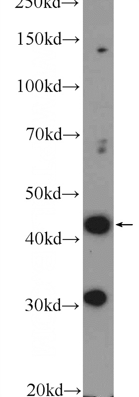 HEK-293 cells were subjected to SDS PAGE followed by western blot with Catalog No:108538(BTBD8 Antibody) at dilution of 1:300