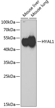Western blot - HYAL1 Polyclonal Antibody 