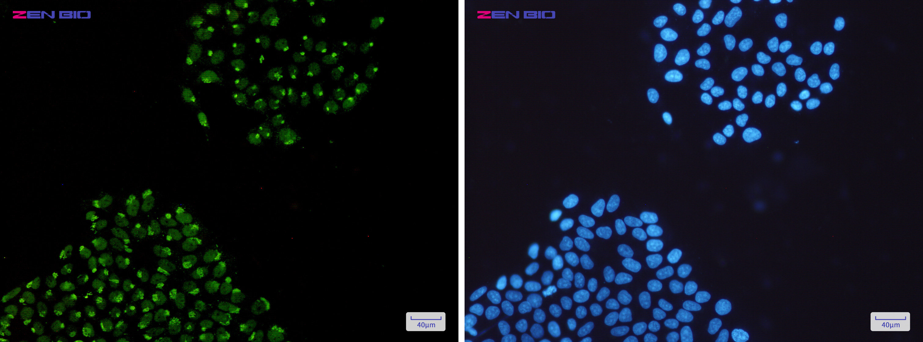 Immunocytochemistry of hnRNP Q(green) in Hela cells using hnRNP Q Rabbit mAb at dilution 1/200, and DAPI(blue)