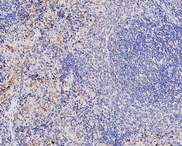 Fig3:; Immunohistochemical analysis of paraffin-embedded rat spleen tissue using anti-IL18 binding protein antibody. The section was pre-treated using heat mediated antigen retrieval with Tris-EDTA buffer (pH 8.0-8.4) for 20 minutes.The tissues were blocked in 5% BSA for 30 minutes at room temperature, washed with ddH; 2; O and PBS, and then probed with the primary antibody ( 1/200) for 30 minutes at room temperature. The detection was performed using an HRP conjugated compact polymer system. DAB was used as the chromogen. Tissues were counterstained with hematoxylin and mounted with DPX.