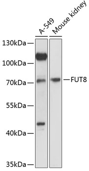 Western blot - FUT8 Polyclonal Antibody 